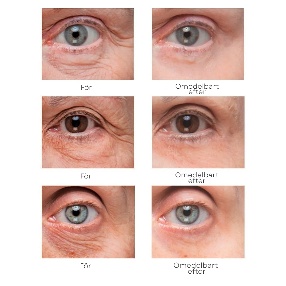 WestMonth Bright Up - Mörka ringar och rynkor försvinner synligt på 60 sekunder ✨