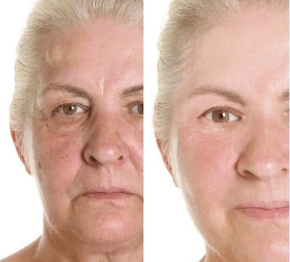 BioLift™ - Stödjer hudens naturliga återhämtning – för färre linjer och mer fasthet, på ett skonsamt sätt.