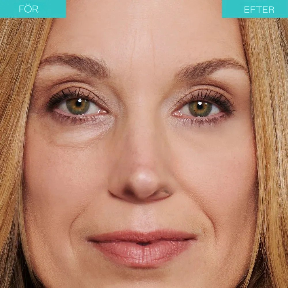 Westmonth Bright Up - Mörka ringar och rynkor försvinner synligt på 60 sekunder ✨