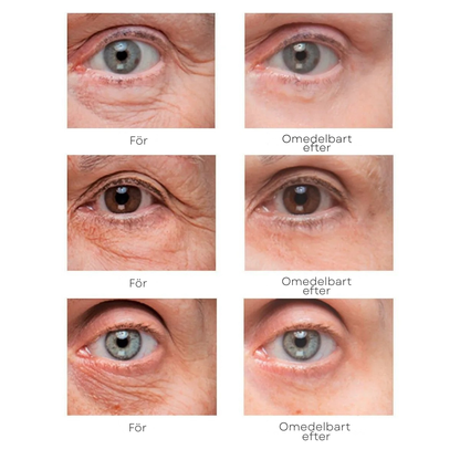 Westmonth Bright Up - Mörka ringar och rynkor försvinner synligt på 60 sekunder ✨