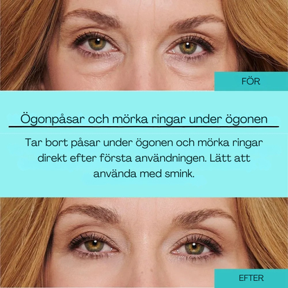 Westmonth Bright Up - Mörka ringar och rynkor försvinner synligt på 60 sekunder ✨